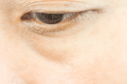 how to conceal under eye bags